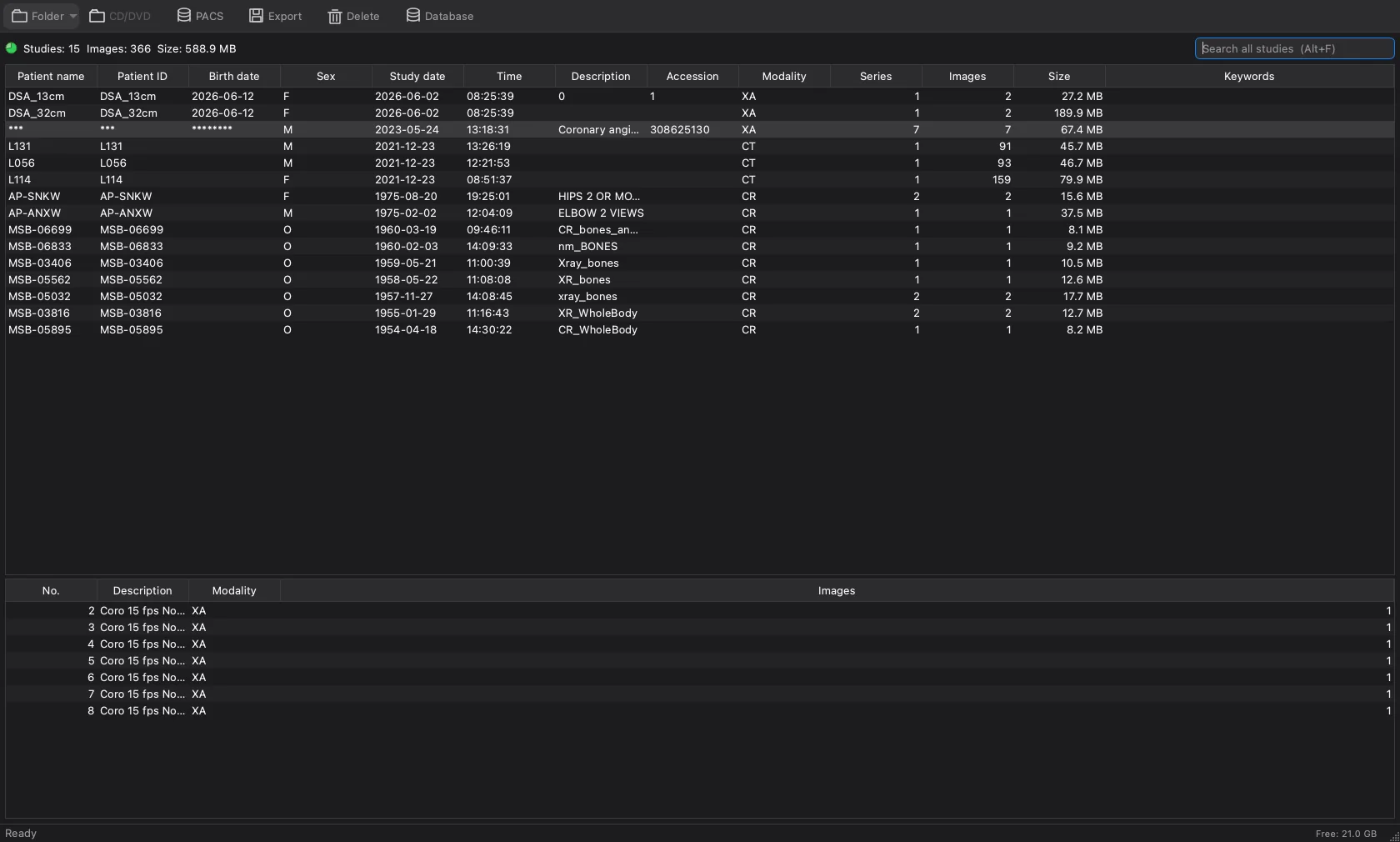 The OmniDICOM local archive listing fifteen de-identified studies with patient code, study date, modality, series and image counts and size, and the series of the selected study in the pane below.