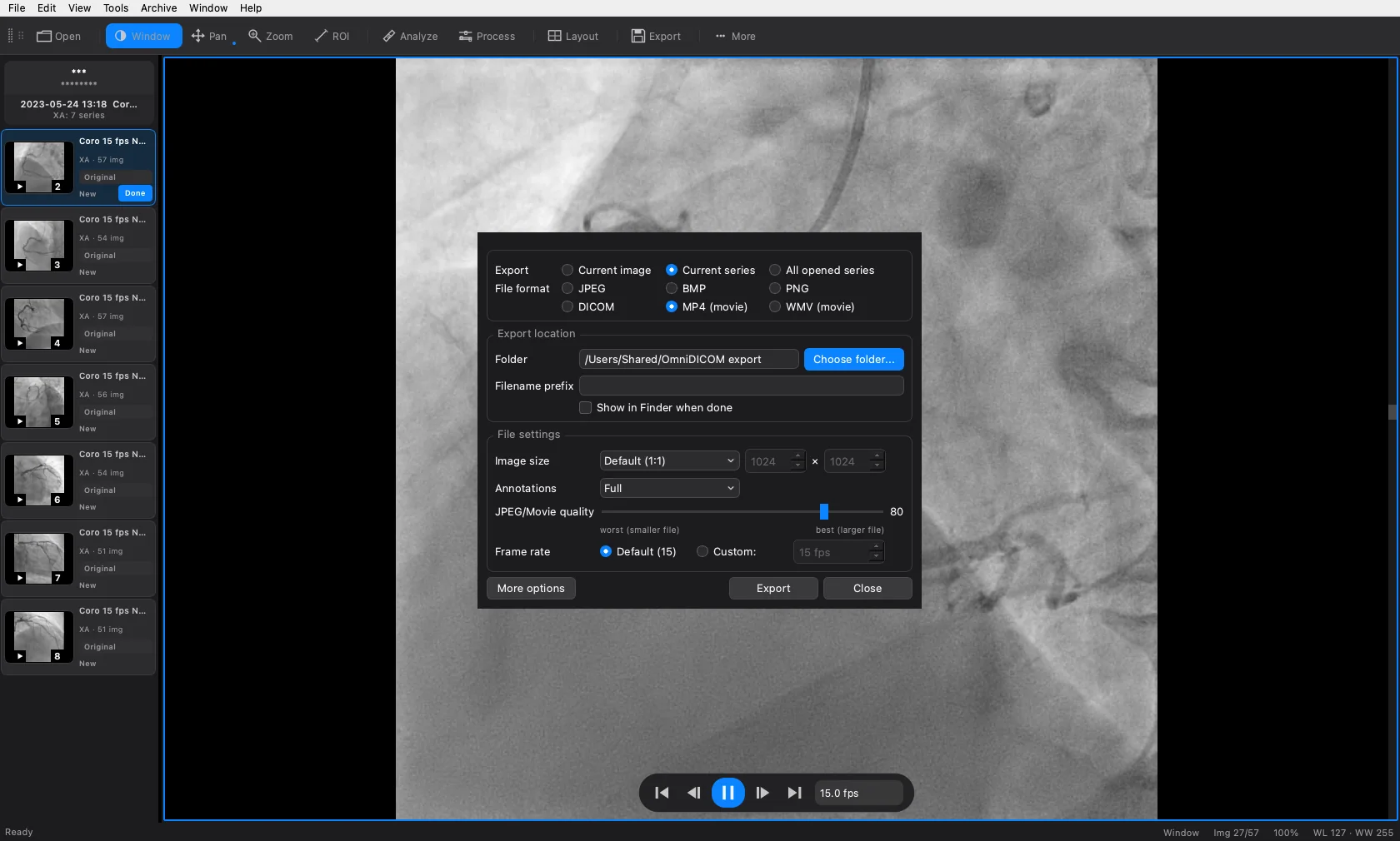 The OmniDICOM export window open over an angiographic run, offering current image, current series or all opened series, and the formats JPEG, BMP, PNG, DICOM, MP4 and WMV, with the destination folder, filename prefix, image size, annotation and frame-rate settings below.